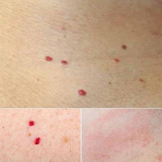 Causes and Meanings of Red Spots on Your Skin