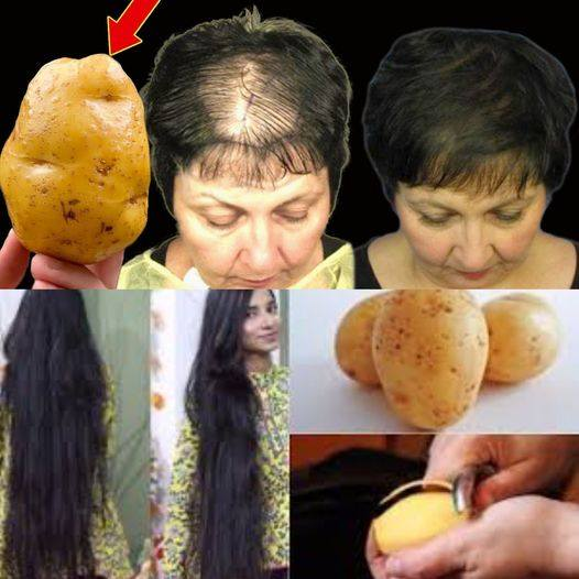 Hair Grows Like Crazy and Doesn’t Fall Out! Discover the Powerful Potato Recipe