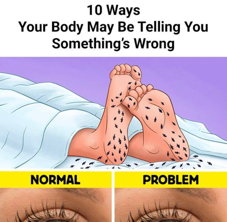 10 Ways Your Body May Be Telling You Something’s Wrong