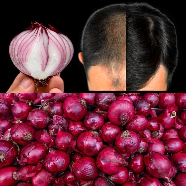 Hair grows quickly and does not shed easily! This is a potent treatment with very effective ingredients, such as red onion.