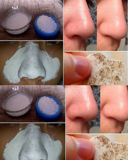 Use A Few Ingredients, They Will Help You Say Goodbye To Big Pores