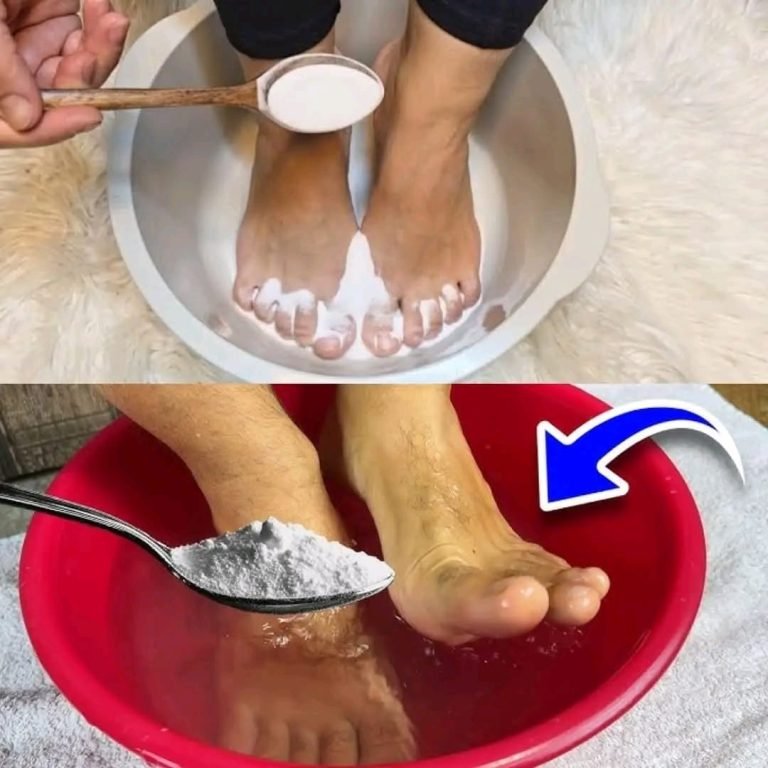 I Put Baking Soda on My Feet, and Look What Happened!