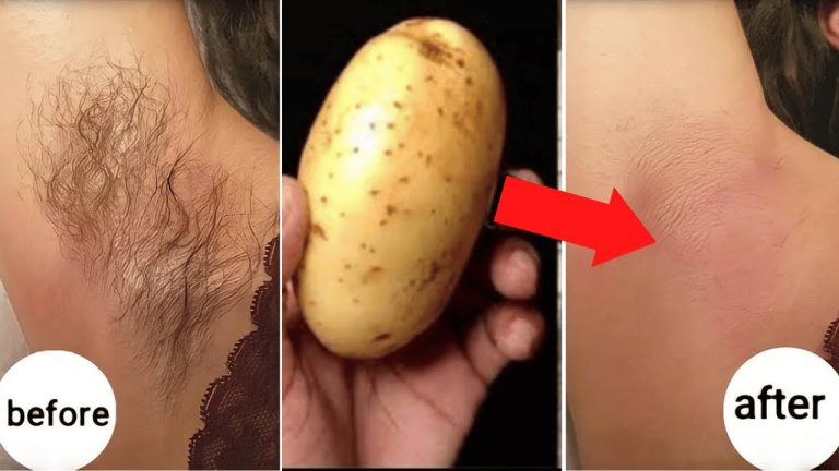 Stop Shaving! Here’s How to Permanently Get Rid of Facial, Body, and Pubic Hair