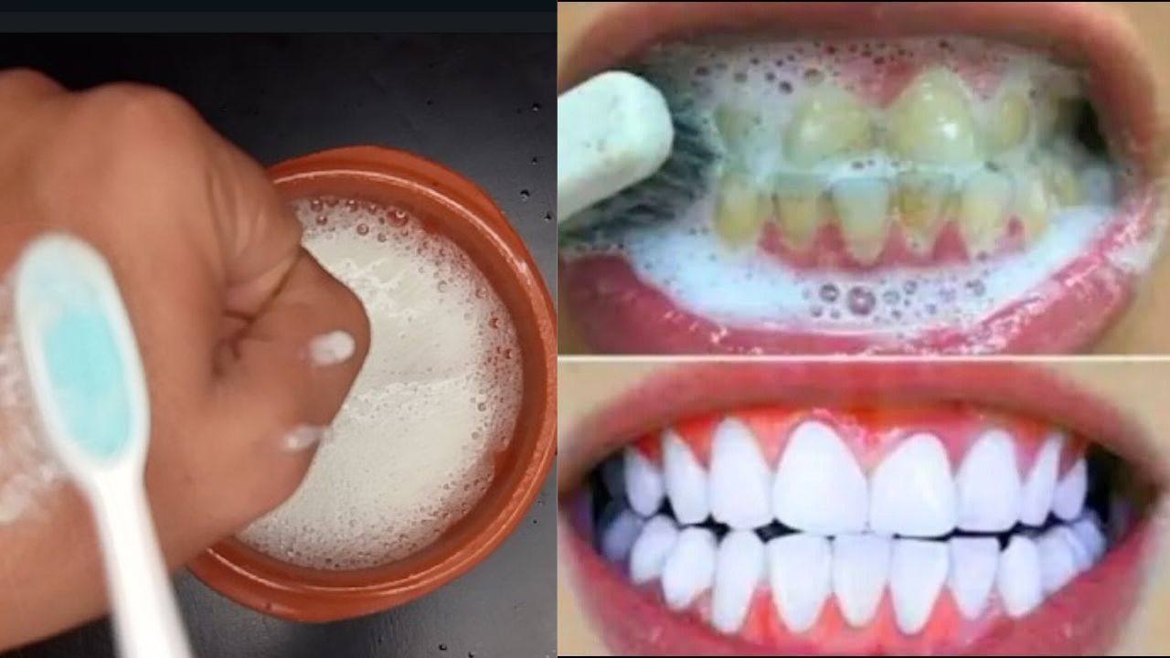 How to Whiten Teeth at Home Naturally in 3 Minutes | Quick & Easy Teeth Whitening Tips