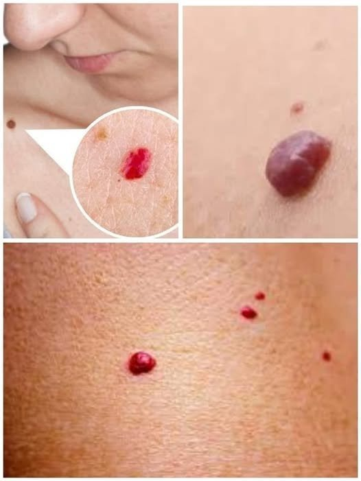 If You Spot These Red Dots On Your Skin, Here’s What They Mean