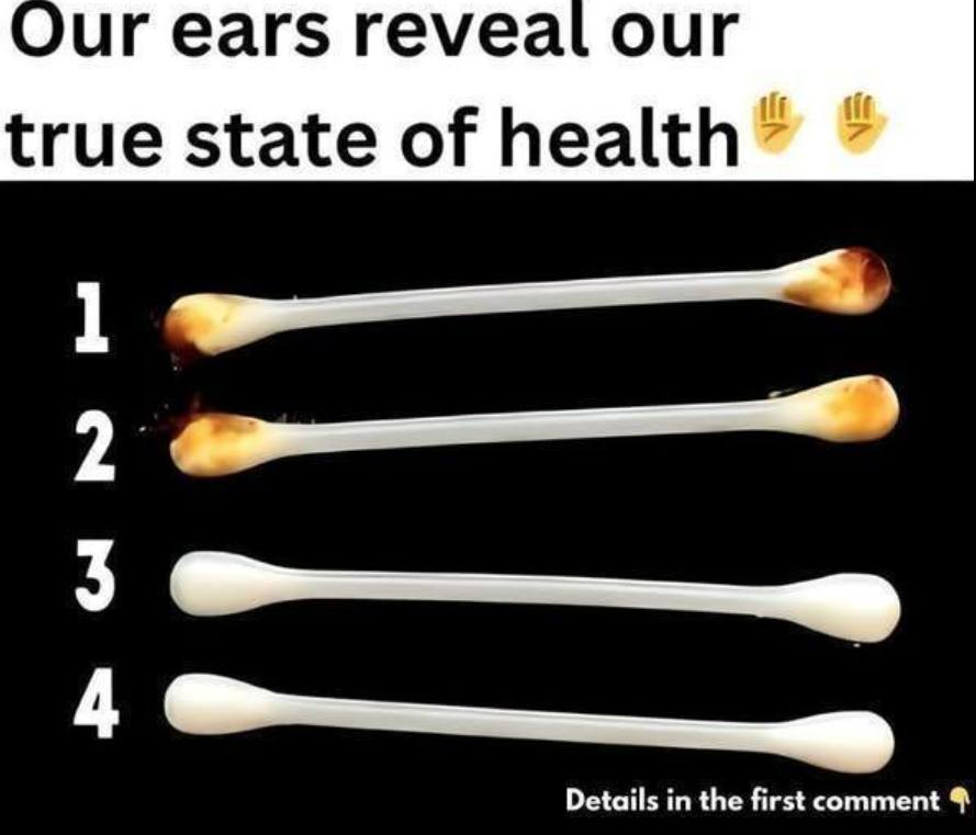 Our ears reveal our true state of health