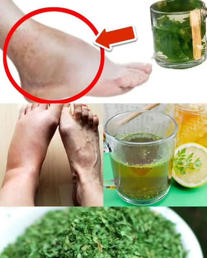 This Tea Removes Swelling in the Feet and Legs – Try Parsley Tea!